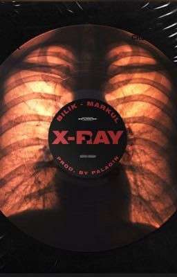 X-RAY
