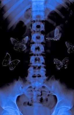 •ты идиот, Мурмаер• 